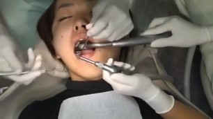Asian Dental Extraction