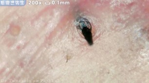 High-magnification video that pulls out the beard