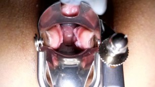 Forcibly make orgasm while open vagina with speculum