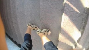 Toe amputee on the street