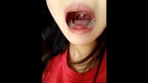 girl show her uvula