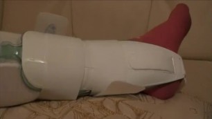 Two girls in socks share one aircast for sprain