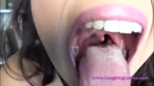 Latina silver fillings