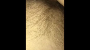 HAIRY SNAP TEEN