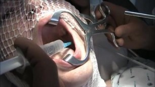 dentist fetish torture. female patient