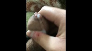 Phimosis teen penis musterbation