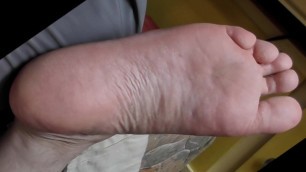 Saline foot injection