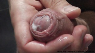 Mein Penis - Vorhaut, Foreskin, Cum, Closeup 5