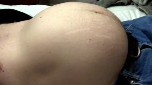 bear gut pushing out expanding belly making stretch marks